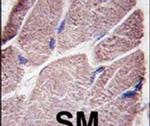 PTPN21 Antibody in Immunohistochemistry (IHC)