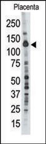 PTPN21 Antibody in Western Blot (WB)