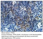 PTPD1 Antibody in Immunohistochemistry (IHC)