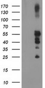 PTPN1 Antibody in Western Blot (WB)
