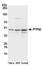 PTPN2/TCPTP Antibody in Western Blot (WB)