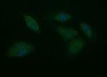 PTPRC Antibody in Immunocytochemistry (ICC/IF)