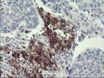 PTPRC Antibody in Immunohistochemistry (Paraffin) (IHC (P))
