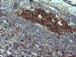 PTPRC Antibody in Immunohistochemistry (Paraffin) (IHC (P))