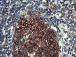 PTPRC Antibody in Immunohistochemistry (Paraffin) (IHC (P))