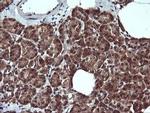 PTPRC Antibody in Immunohistochemistry (Paraffin) (IHC (P))