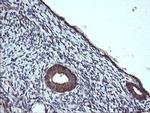PTPRC Antibody in Immunohistochemistry (Paraffin) (IHC (P))