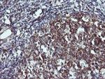 PTPRC Antibody in Immunohistochemistry (Paraffin) (IHC (P))