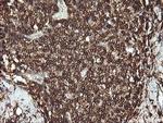 PTPRC Antibody in Immunohistochemistry (Paraffin) (IHC (P))
