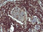 PTPRC Antibody in Immunohistochemistry (Paraffin) (IHC (P))