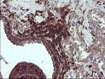 PTPRC Antibody in Immunohistochemistry (Paraffin) (IHC (P))