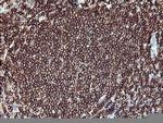 PTPRC Antibody in Immunohistochemistry (Paraffin) (IHC (P))
