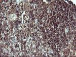 PTPRC Antibody in Immunohistochemistry (Paraffin) (IHC (P))
