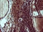 PTPRC Antibody in Immunohistochemistry (Paraffin) (IHC (P))
