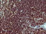 PTPRC Antibody in Immunohistochemistry (Paraffin) (IHC (P))