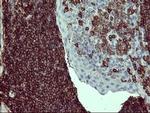 PTPRC Antibody in Immunohistochemistry (Paraffin) (IHC (P))