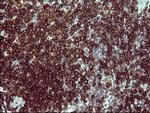 PTPRC Antibody in Immunohistochemistry (Paraffin) (IHC (P))
