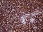 PTPRC Antibody in Immunohistochemistry (Paraffin) (IHC (P))