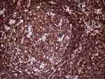 PTPRC Antibody in Immunohistochemistry (Paraffin) (IHC (P))