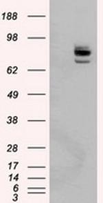 PTPRE Antibody in Western Blot (WB)