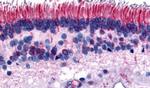 PTPRM Antibody in Immunohistochemistry (Paraffin) (IHC (P))