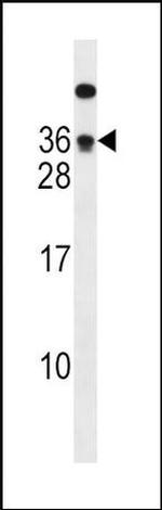 PTPRA Antibody in Western Blot (WB)