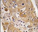 PTRF Antibody in Immunohistochemistry (IHC)