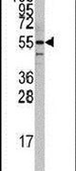 PTRF Antibody in Western Blot (WB)