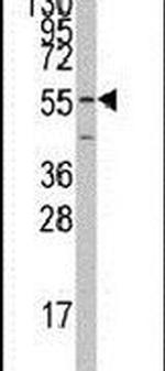 PTRF Antibody in Western Blot (WB)