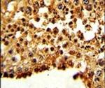 Securin Antibody in Immunohistochemistry (IHC)