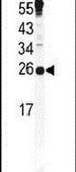 Securin Antibody in Western Blot (WB)