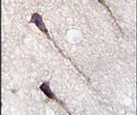 PUM1 Antibody in Immunohistochemistry (IHC)