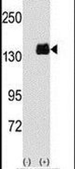 PUM1 Antibody in Western Blot (WB)