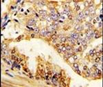 PUM2 Antibody in Immunohistochemistry (IHC)