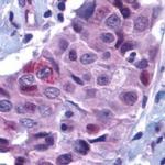 PUMA alpha Polyclonal Antibody