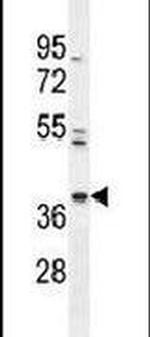 PURG Antibody in Western Blot (WB)