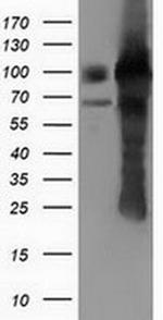 PUS7 Antibody in Western Blot (WB)