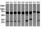 PUS7 Antibody in Western Blot (WB)
