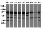 PUS7 Antibody in Western Blot (WB)