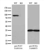 PUS7 Antibody in Western Blot (WB)