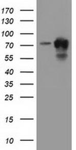 PUS7 Antibody in Western Blot (WB)