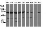 PUS7 Antibody in Western Blot (WB)