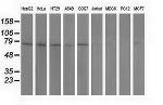 PUS7 Antibody in Western Blot (WB)