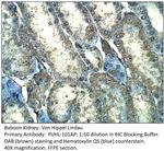 Von Hippel Lindau Polyclonal Antibody