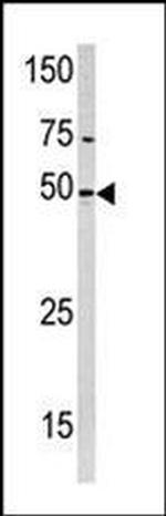 PXK Antibody in Western Blot (WB)