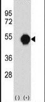 PXK Antibody in Western Blot (WB)
