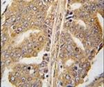 Paxillin Antibody in Immunohistochemistry (IHC)