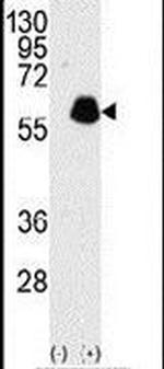 Paxillin Antibody in Western Blot (WB)