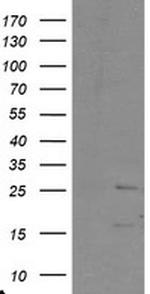 PYCARD Antibody in Western Blot (WB)