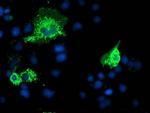 PYCR2 Antibody in Immunocytochemistry (ICC/IF)